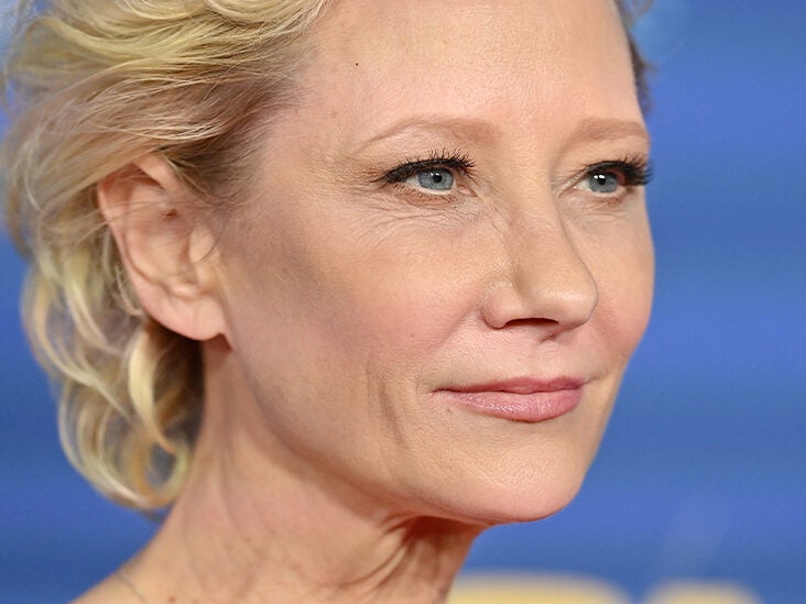 What Anne Heche's Death Teaches Us About Traumatic Brain Injuries and Organ Donation