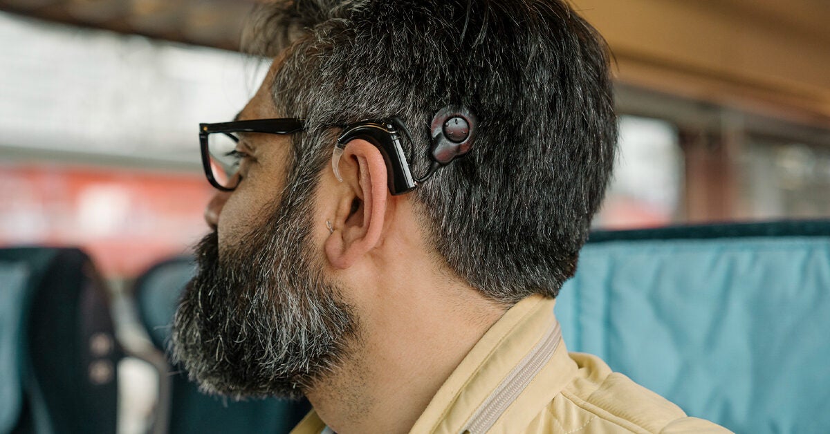 Why Cochlear Implants Are Bad Exploring the Controversy