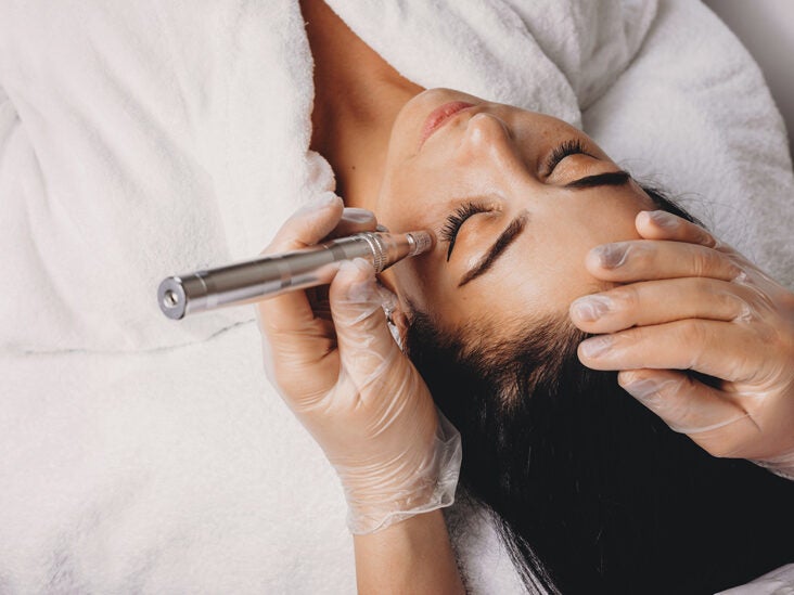 Hyperpigmentation Treatment: Acids, Peels, Lasers, and More