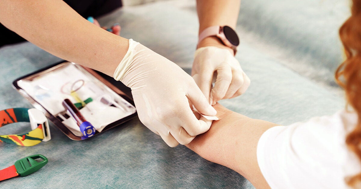 The DDimer Test What to Know