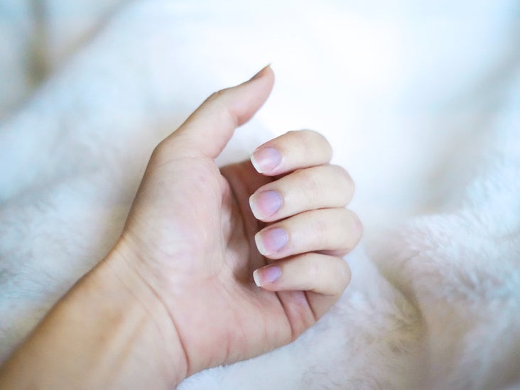 Blue Fingernails: Causes And When To Get Help