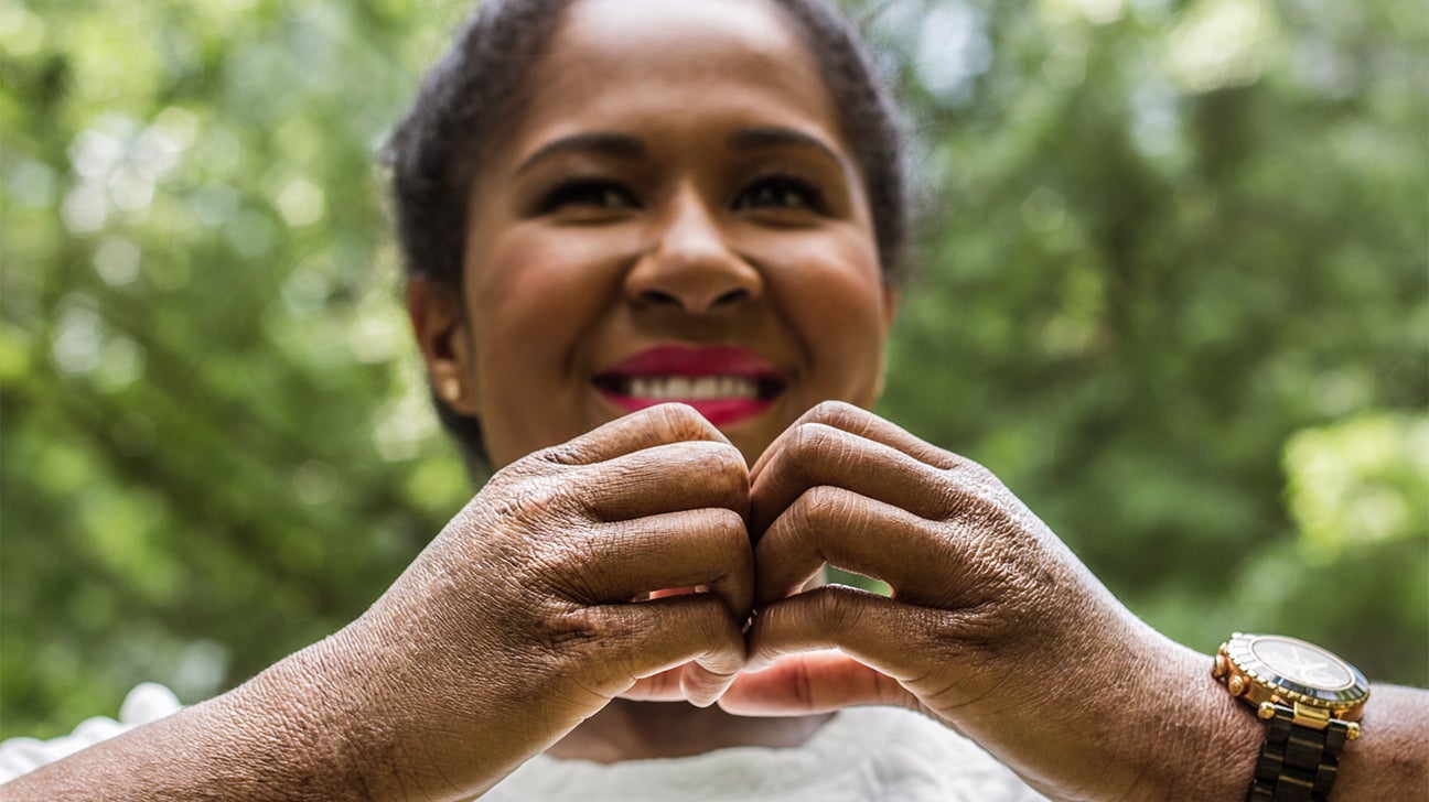 How I Manage Eczema on My Face, Scalp, and Body