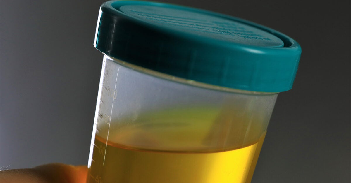 How Long Does Meth Stay In Your Urine Vs Hair Other Side Effects