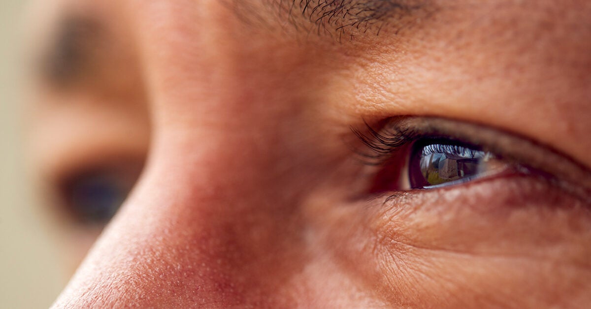 Blepharitis And Vitamin Deficiency Is There A Link 