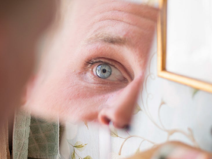 Jaundice Types Causes, Treatments, Diagnosis, and More