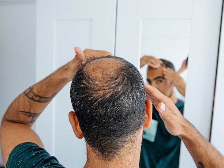 How Long Does It Take for Hair to Grow Back in Various Cases?