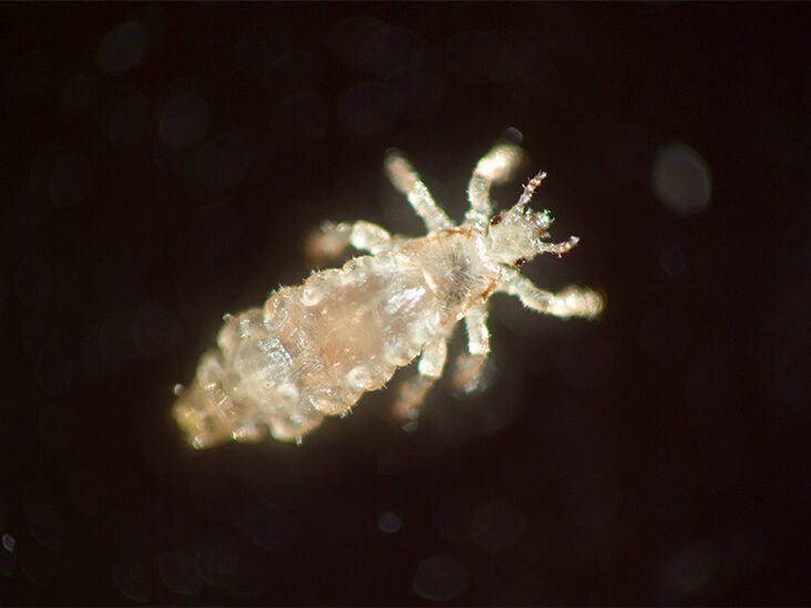What Are Lice, and Where Do They Come From?