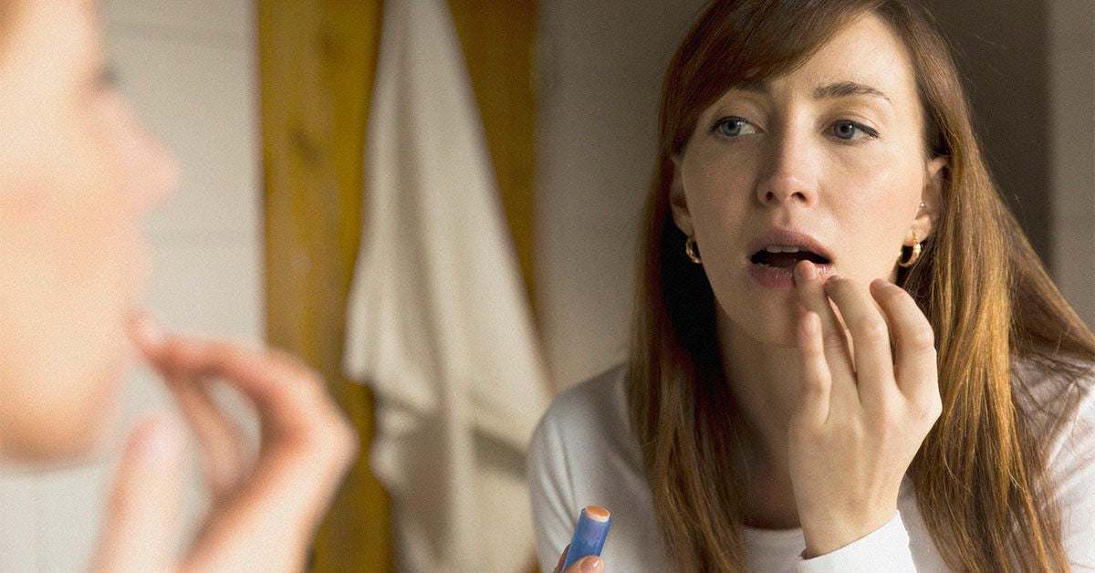 What Causes Lupus Mouth Sores or Ulcers?