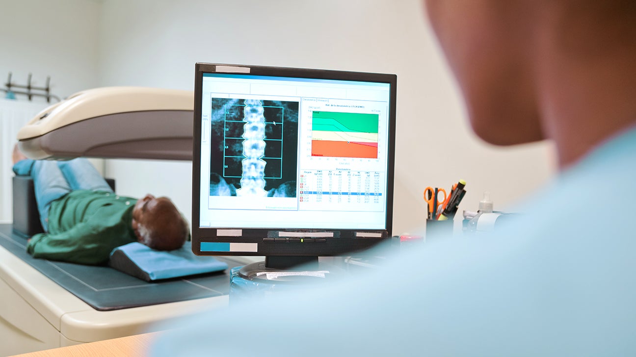 Bone Scan For Osteoporosis: Purpose, Procedure, Results, Cost