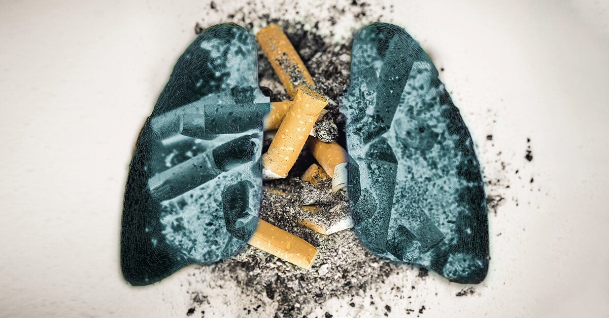 Lung Diseases Caused By Smoking: Symptoms, Treatments, and More