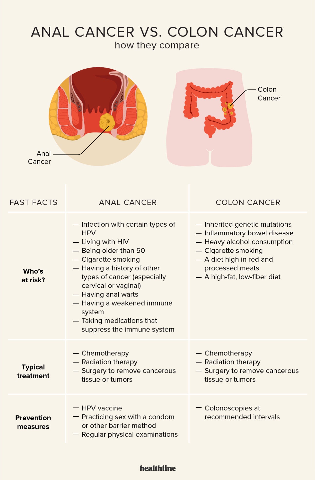 Anal Cancer vs. Colon Cancer: Symptoms, Causes, Treatment