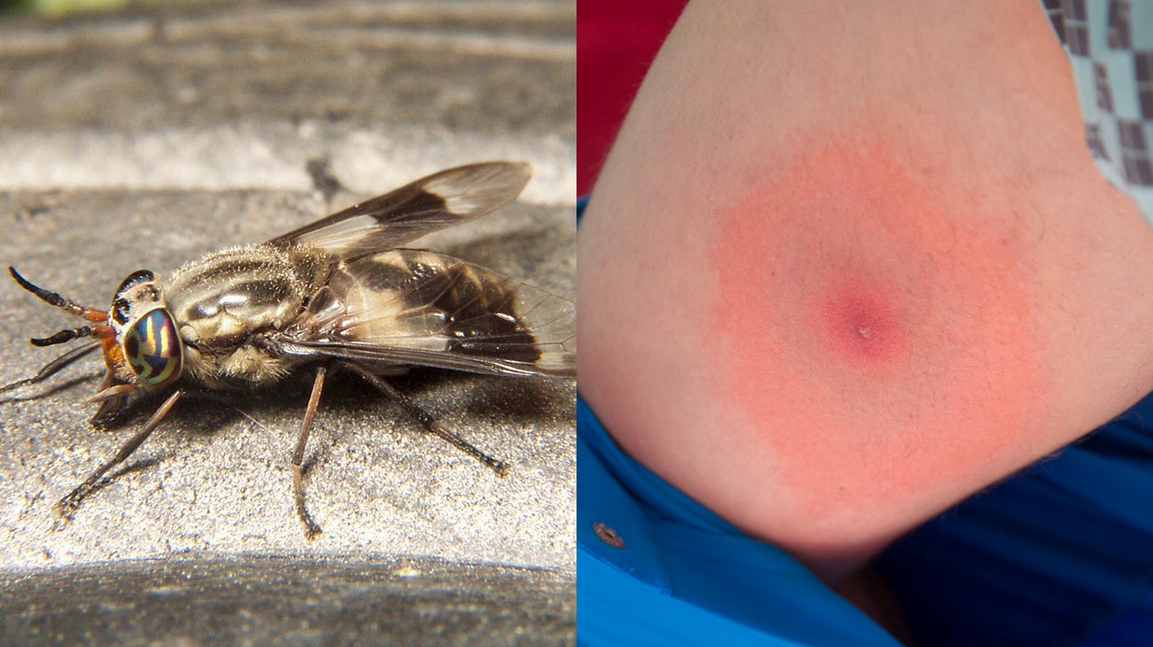 Blandford Fly Bite Symptoms at Carol Sorrels blog