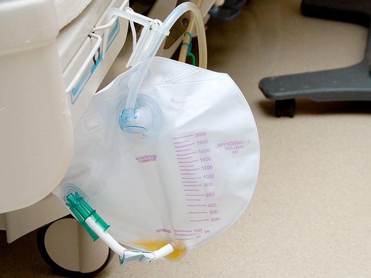 Urinary Wicking Devices Types, Uses, and Benefits