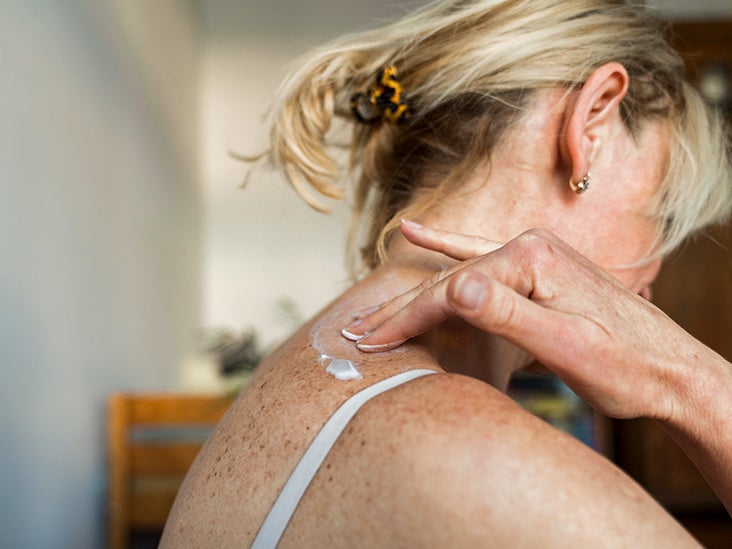 Shingles Itching After Rash Is Gone Causes and Treatment