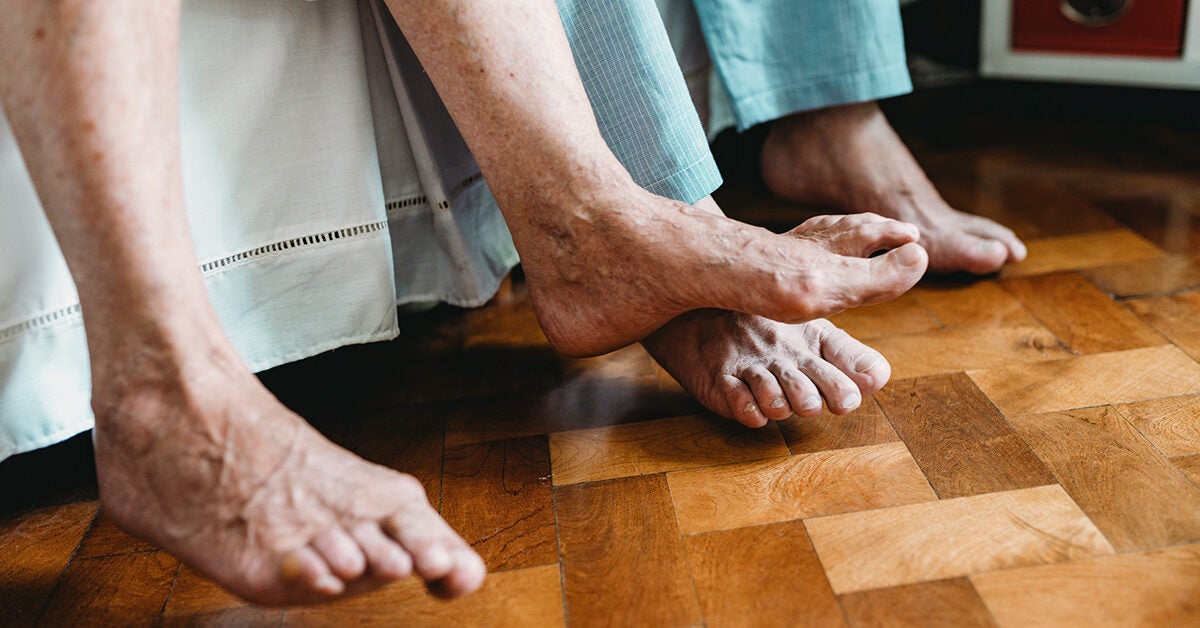 Lymphoma in the Leg Symptoms, Treatment, and More