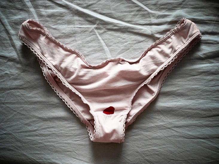 Stress Can Cause Spotting Identification, Treatment, Prevention