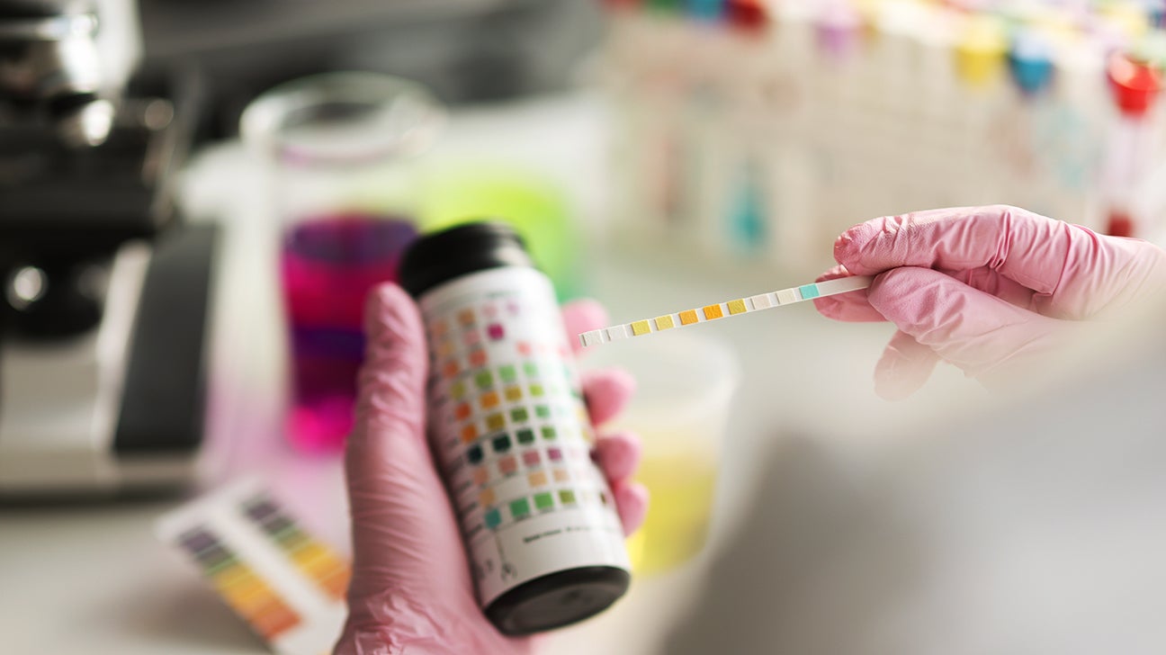Routine urine tests during pregnancy