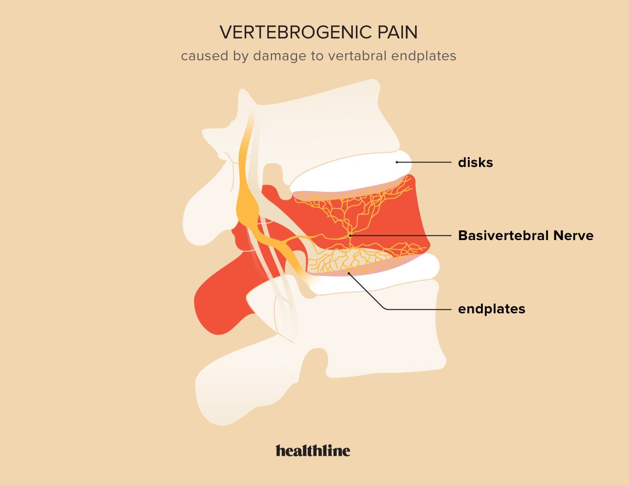 Back Pain: Causes, Symptoms, Diagnosis, Prevention