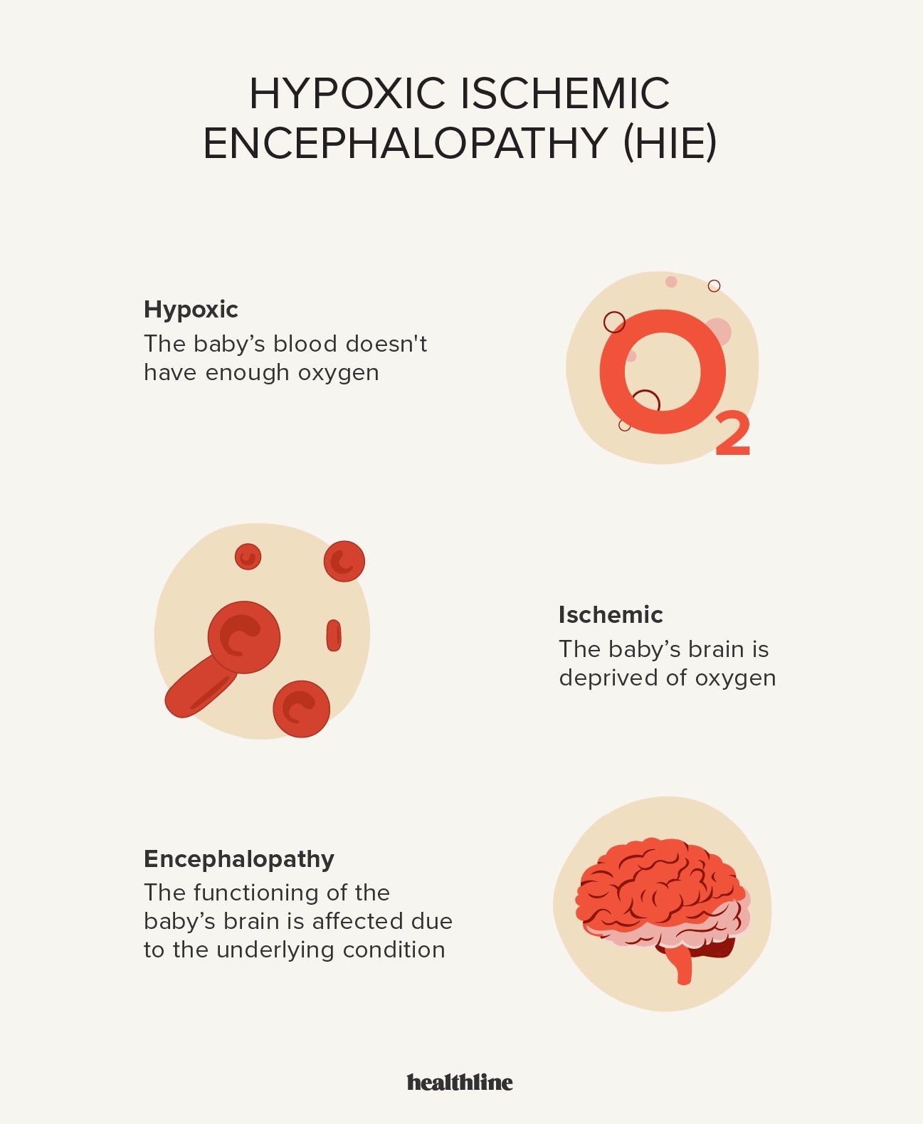 Hypoxic Ischemic Encephalopathy: Causes, Treatments, Outlook