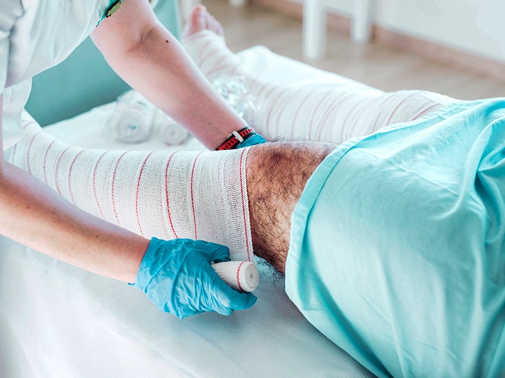 How Long Does It Take for MRSA to Heal?