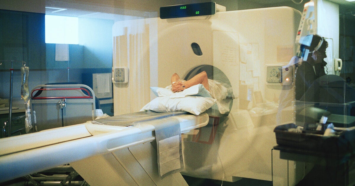 CT scan predicts risk better than genetic score