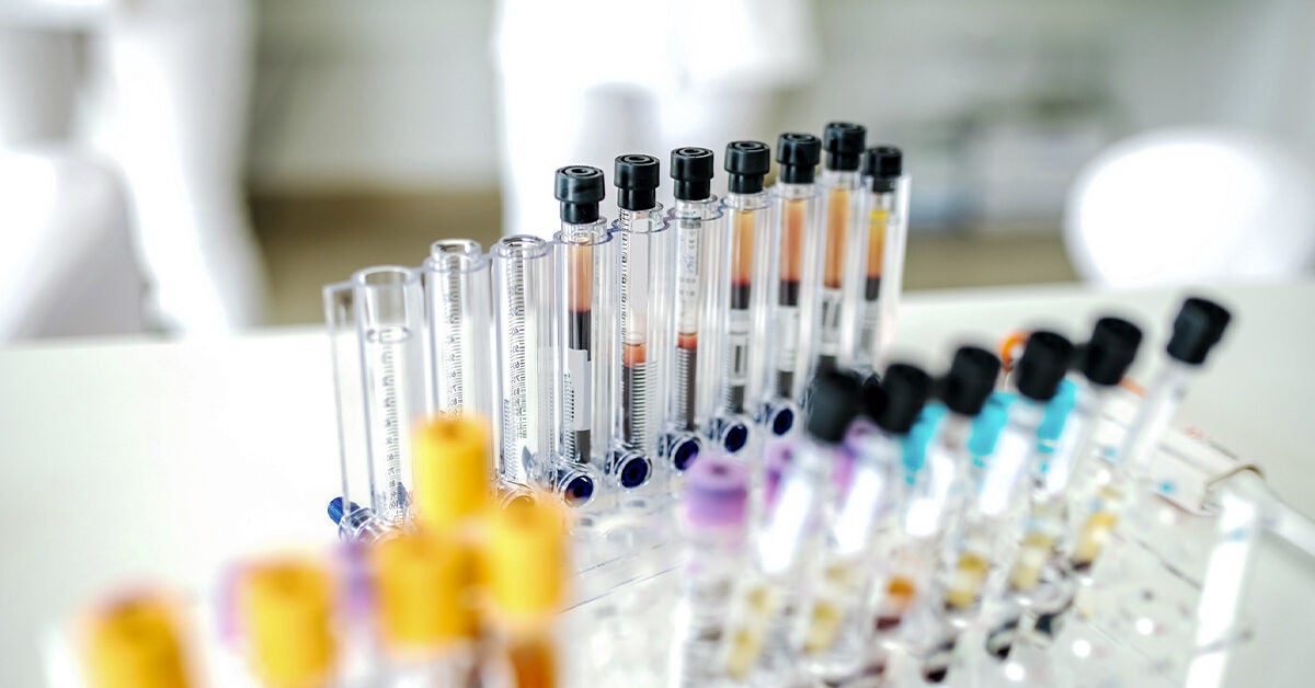 Health Line Lab Intraepithelial Lymphocytosis: Causes, Symptoms, Treatment