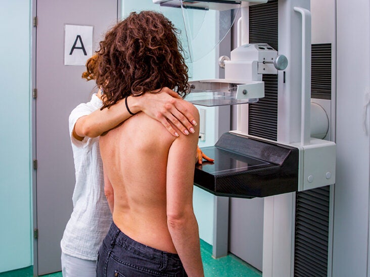 Why Women Should Start Getting Regular Mammograms at Age 40