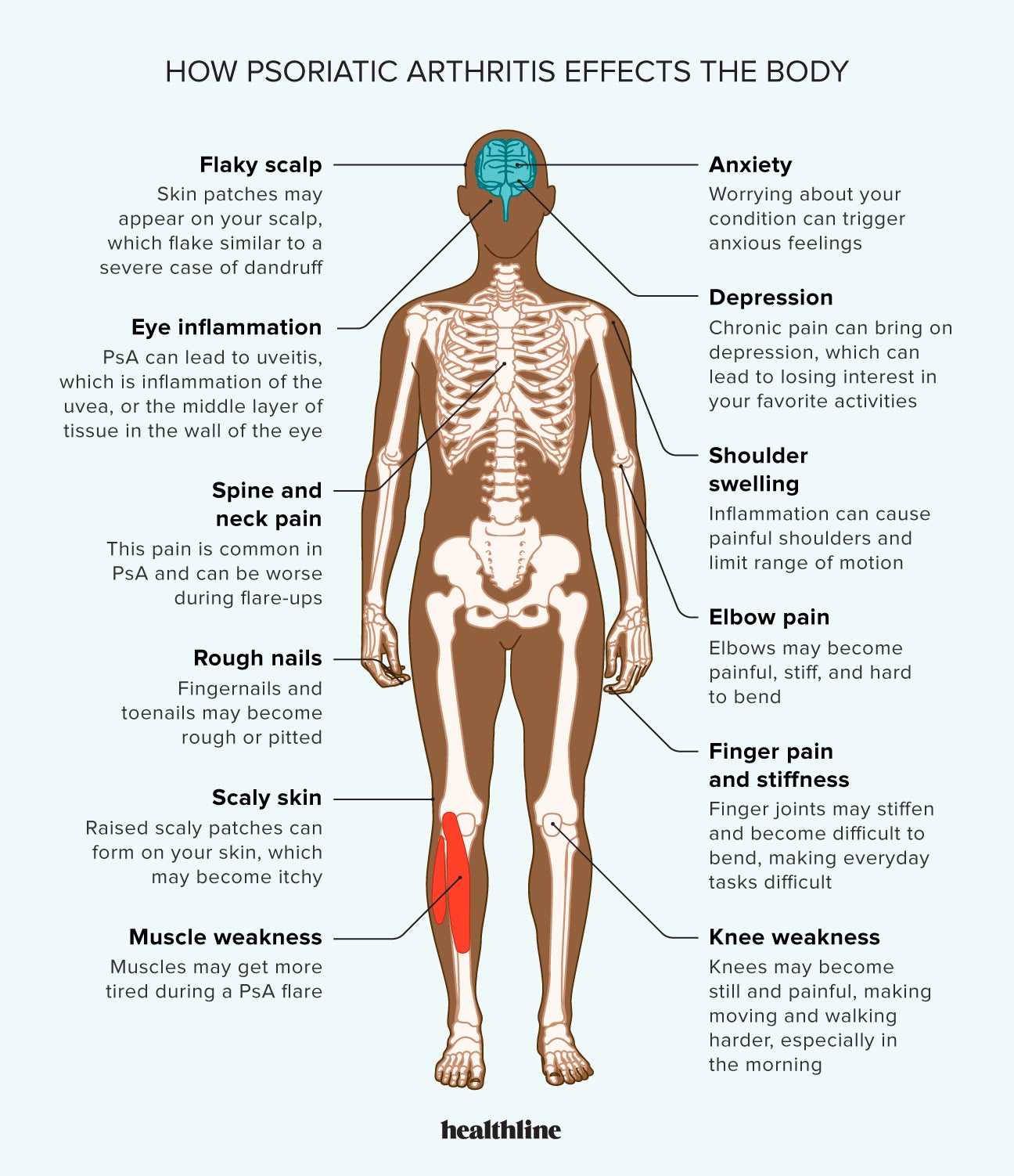 Arthritis, Definition, Causes, & Treatment