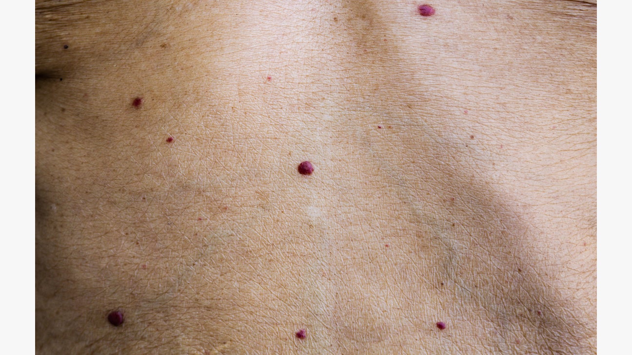 Tiny Red Dots On Skin