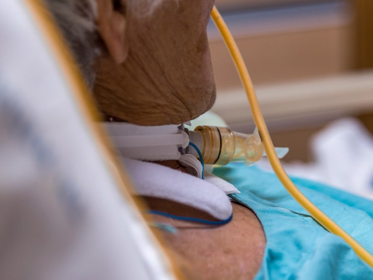 Cricothyrotomy vs. Tracheostomy Procedures, Benefits, Risks