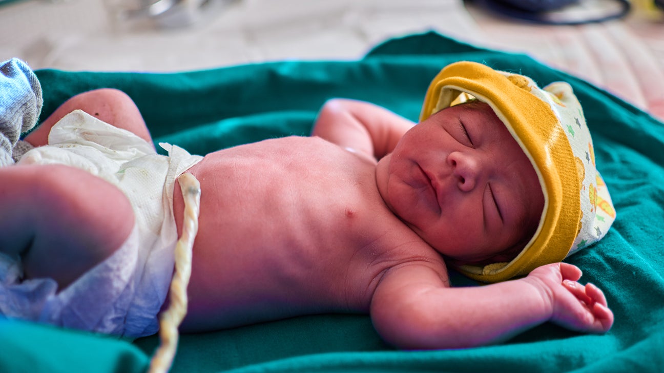 How to care for your newborn's umbilical cord stump
