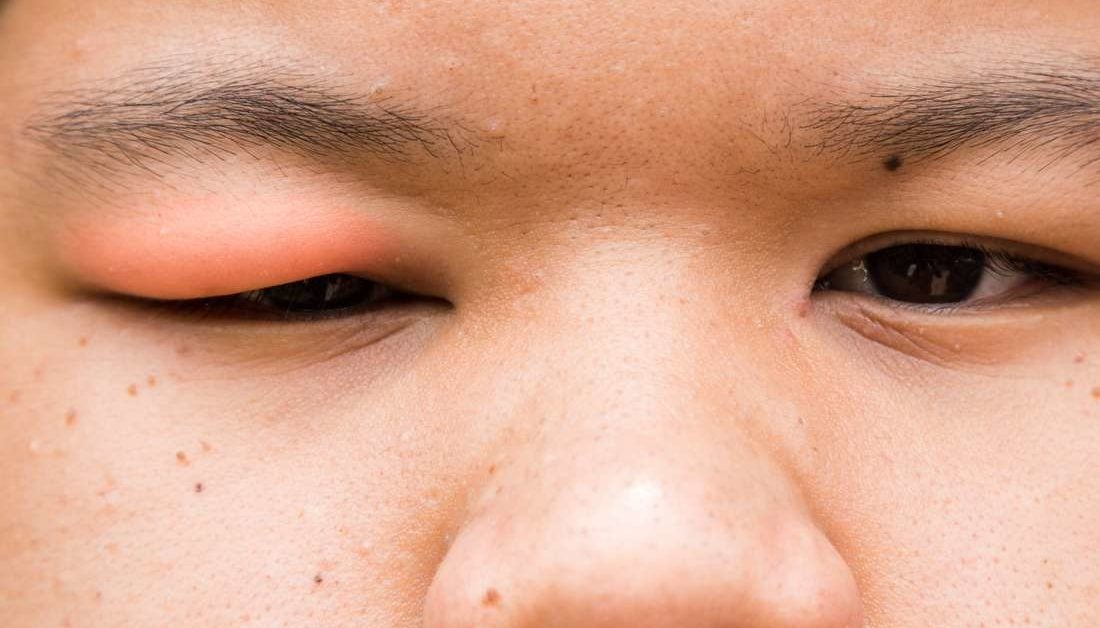 Síntomas de lesiones en la cabeza para niños pequeños