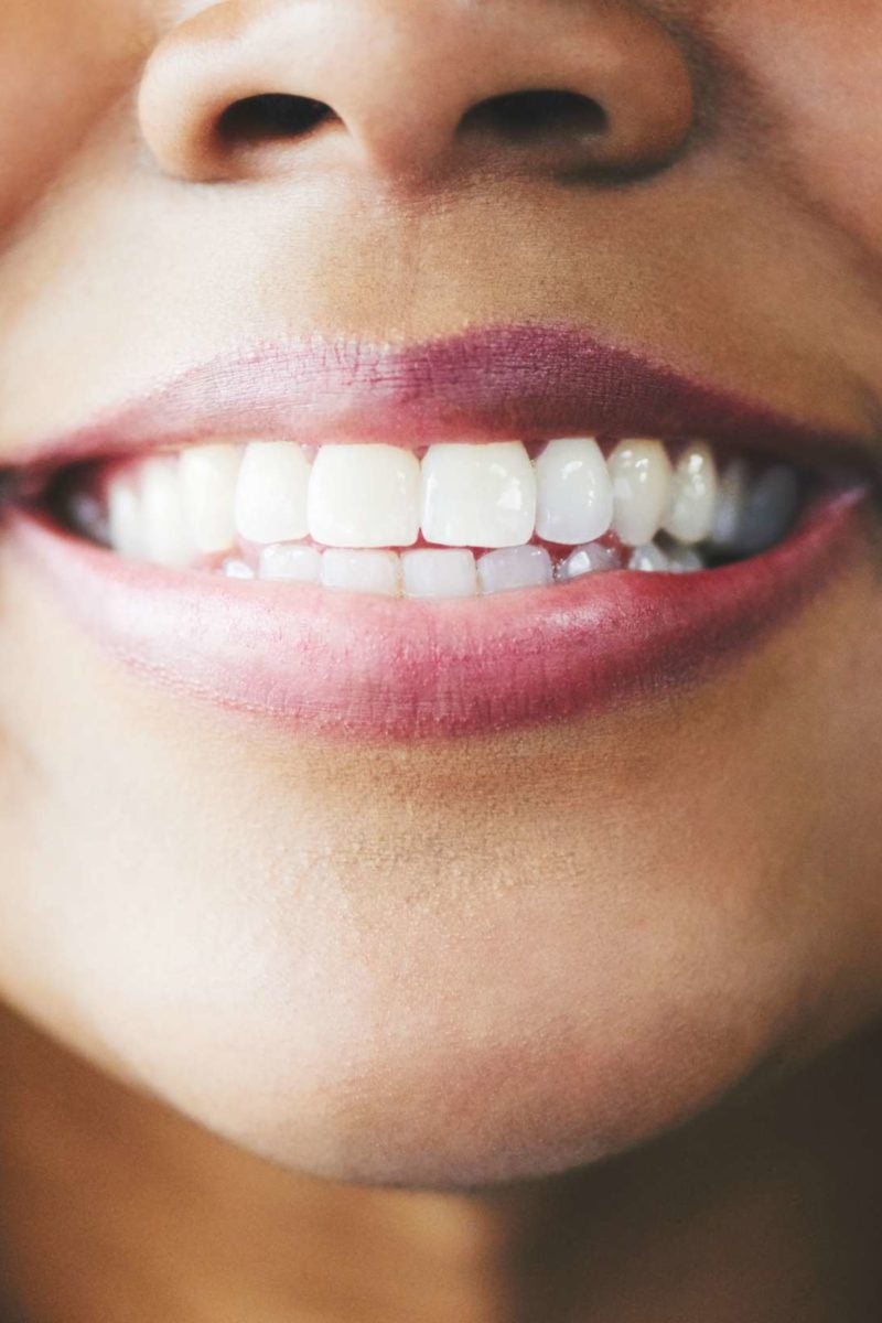 Are Adult Teeth the Same Shape as Baby Teeth?