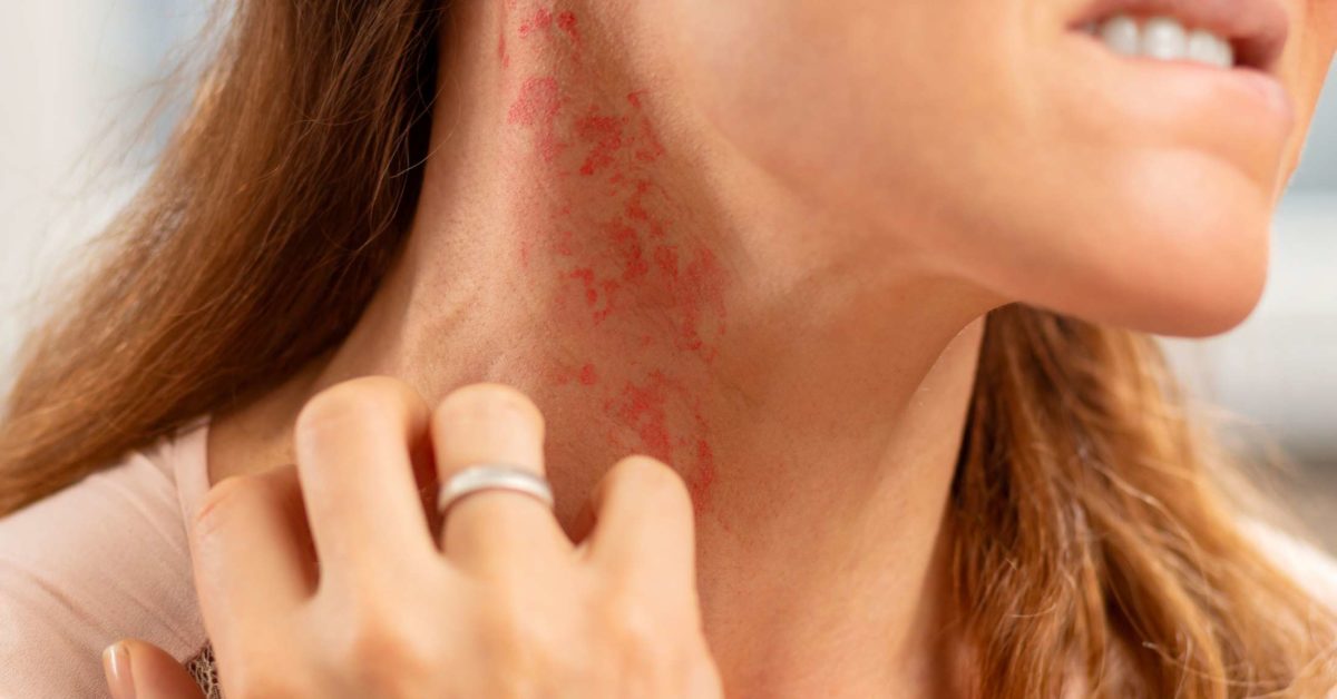 skin rashes that itch and are contagious