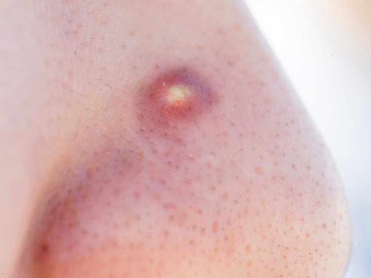 white spots on skin treatment