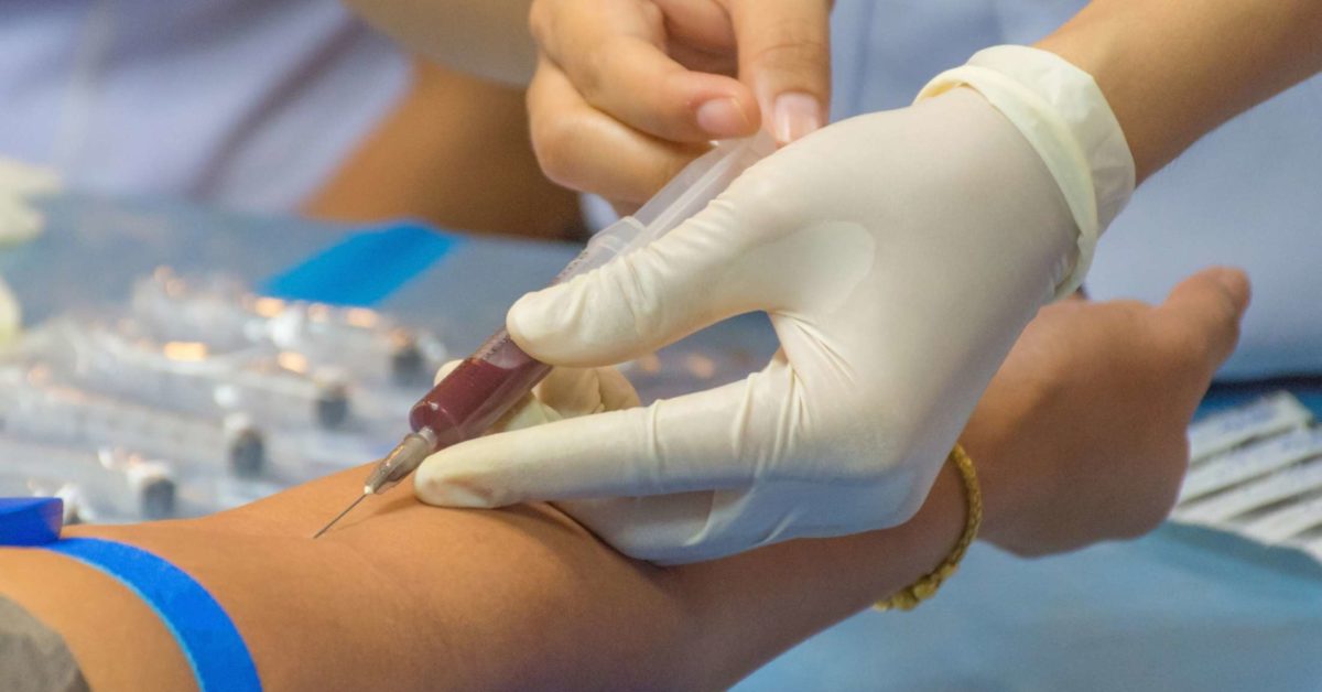 ANA blood test: Purpose, what to expect, results explained, and more