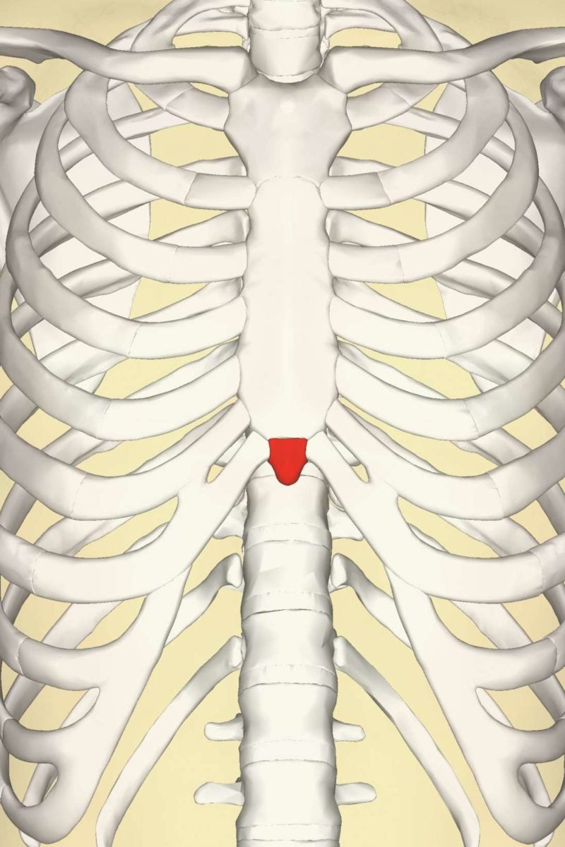 Xiphoid Process Pain Lump And Removal