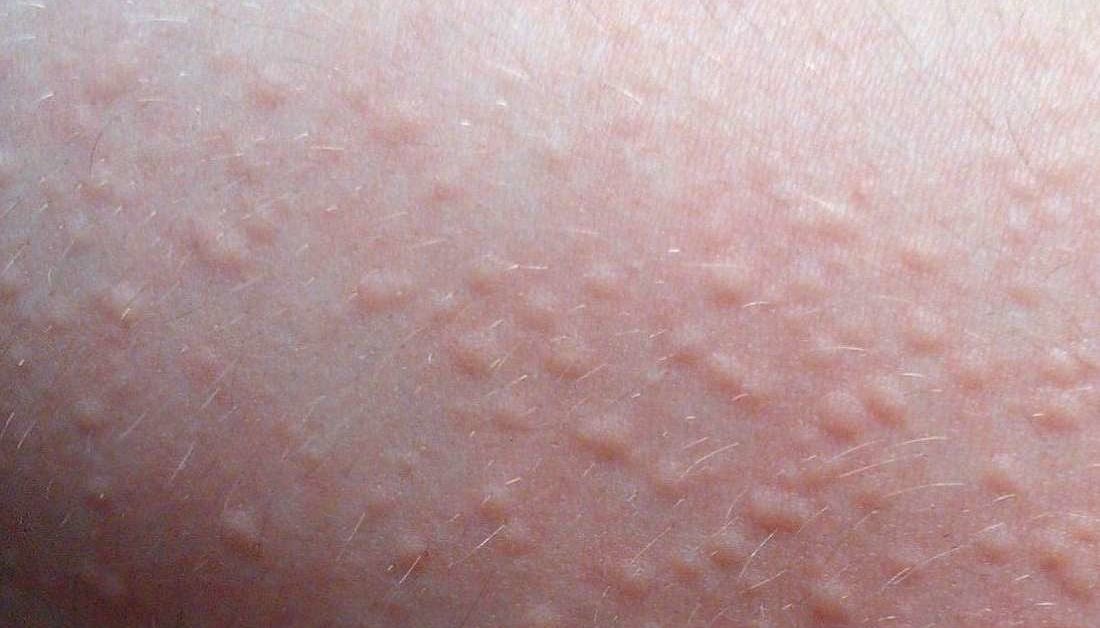 how to treat itchy skin