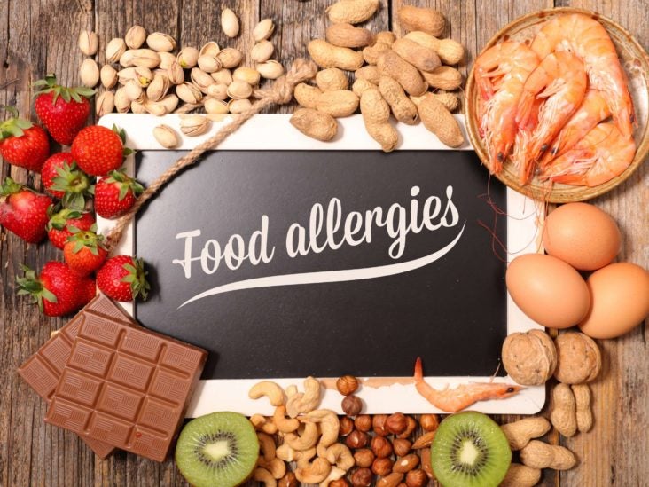 Health How To Manage And Treat Food Allergies Symptoms
