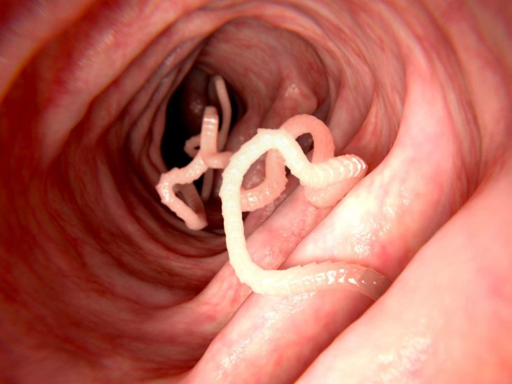 pinworms hatás a testre