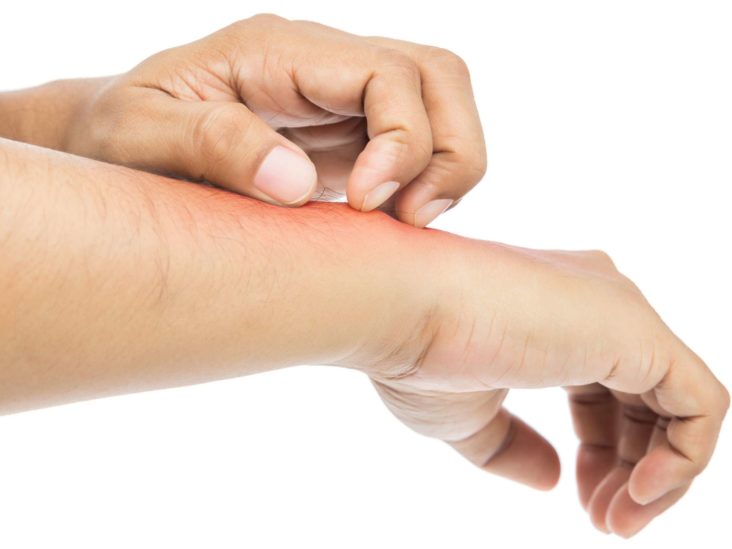 Allergic Reaction To Carpet Fibres