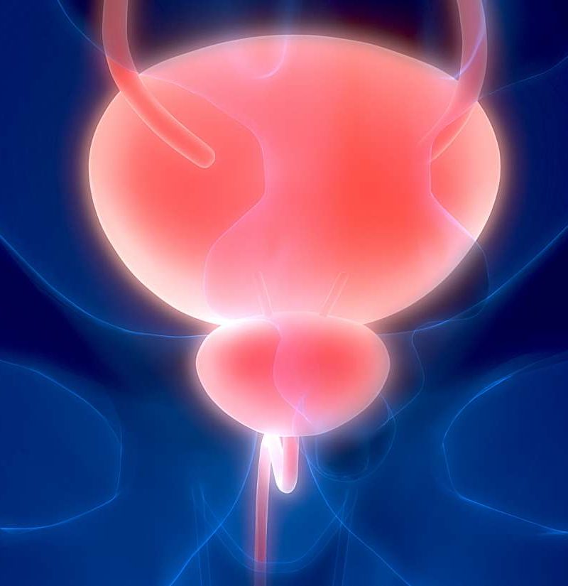 Bladder Spasms Causes Symptoms And Treatment