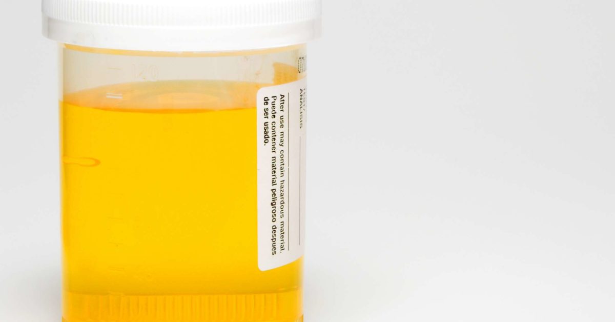 urine-smells-like-sulfur-11-causes-and-treatment