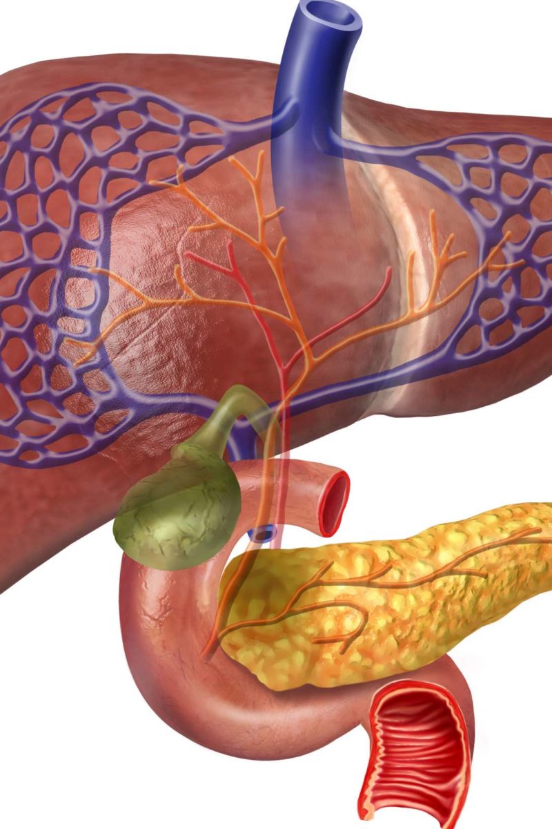 Sphincter of Oddi dysfunction: Symptoms, diet, and relief