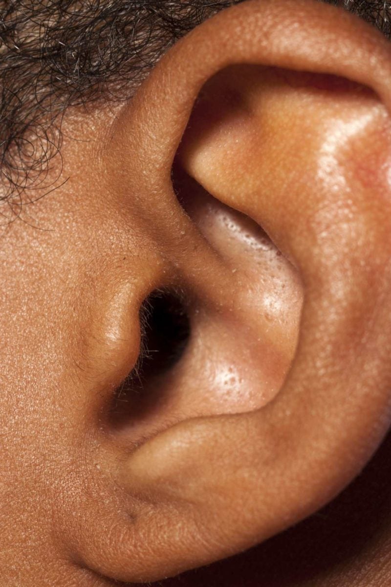 bug-in-ear-symptoms-and-how-to-get-it-out