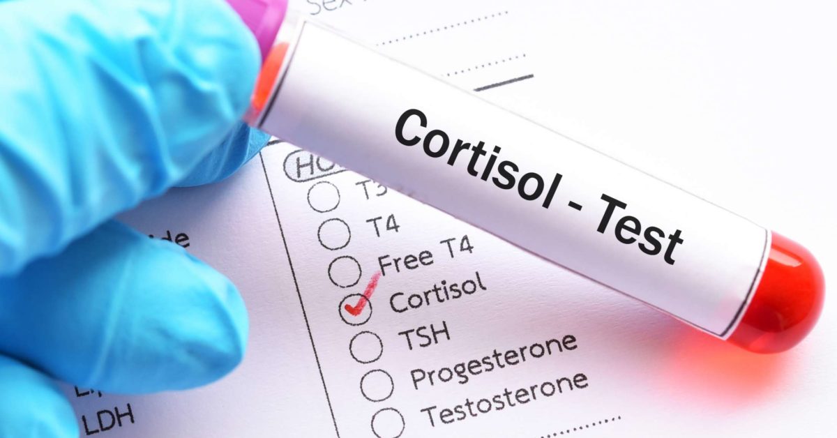 Cortisol Level Test Purpose Procedure And Results