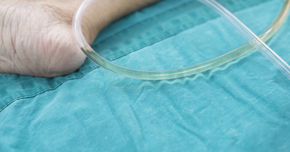 Urinary catheter Uses, types, and what to expect