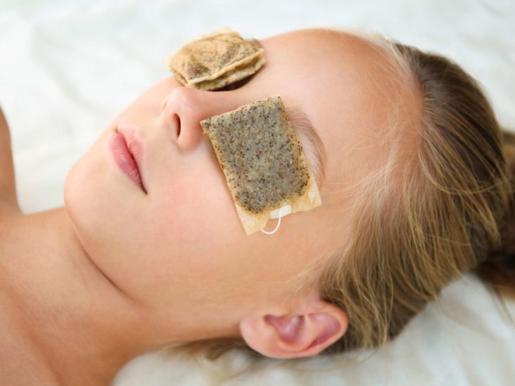 How To Get Rid Of Puffy Eyes From Crying 8 Home Remedies get rid of puffy eyes from crying