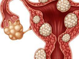 Blood clots during period is it normal