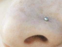 Cartilage Piercing Bump Scars Infections And What To Do